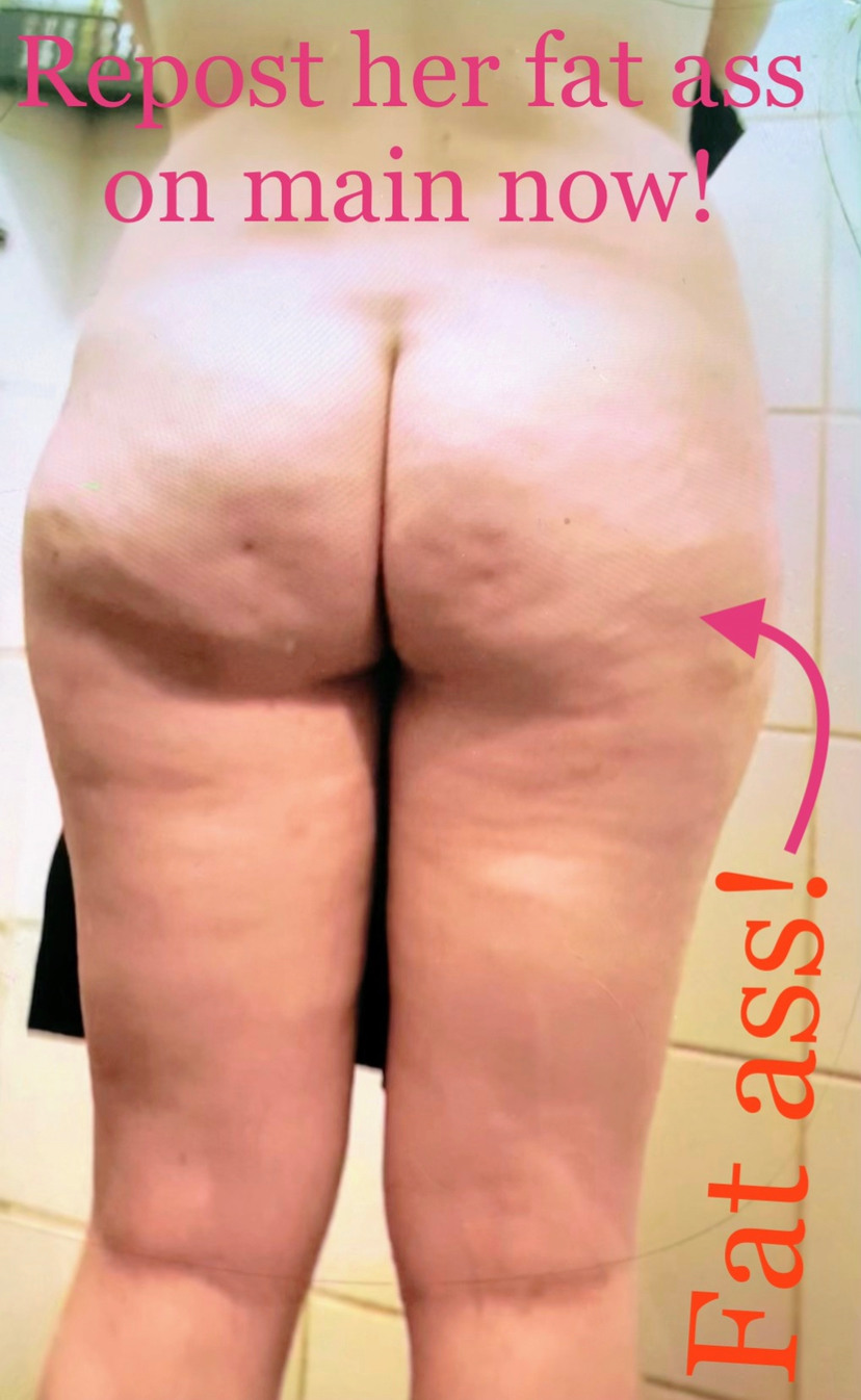 Cottage cheese assed webslut Ellis #ugSh9y5q